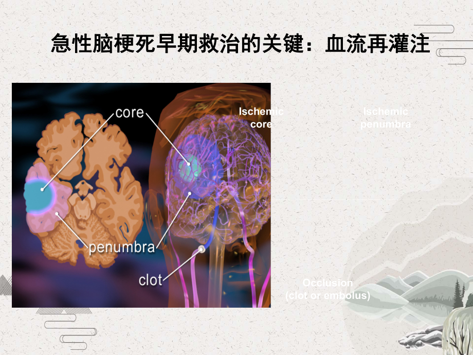 急性脑梗死静脉溶栓指南解读课件.pptx_第3页