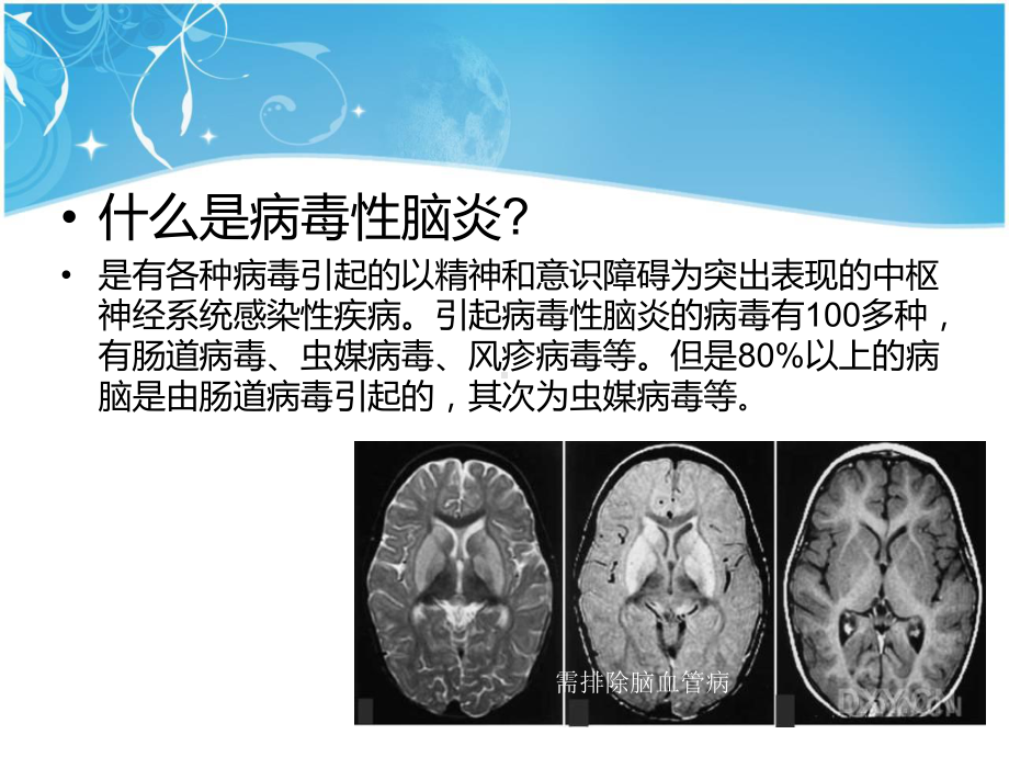 新建-病脑幻灯片修改版课件.ppt_第3页