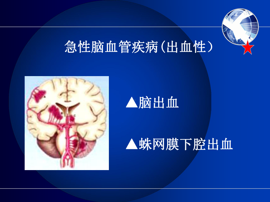 急性脑血管出血性疾病病人护理ppt课件.ppt_第2页