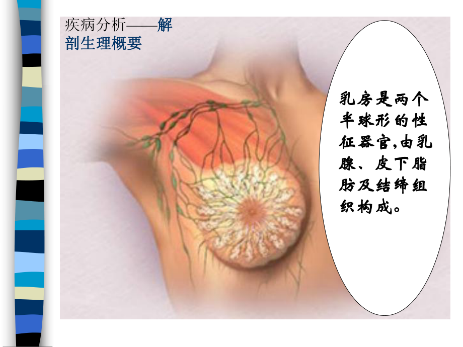 急性化脓性腹膜炎课件.ppt_第3页