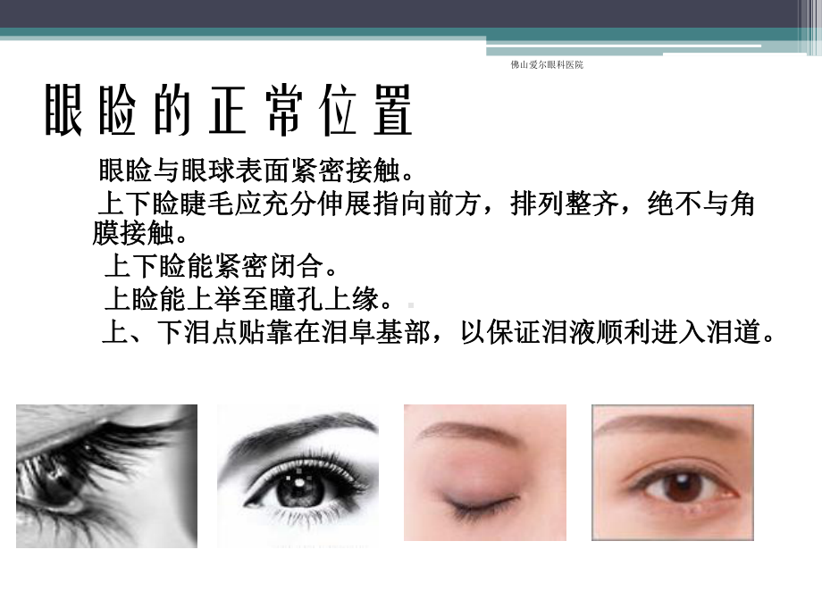 眼睑位置、功能和先天异常课件.ppt_第2页