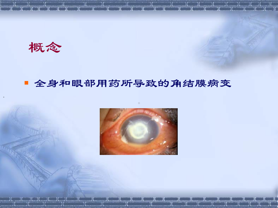 眼睑真菌病合并霰粒肿病一例课件.ppt_第2页