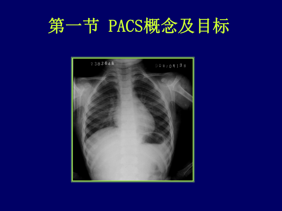 知识]图像存档与通信系统PPT介绍课件.ppt_第3页