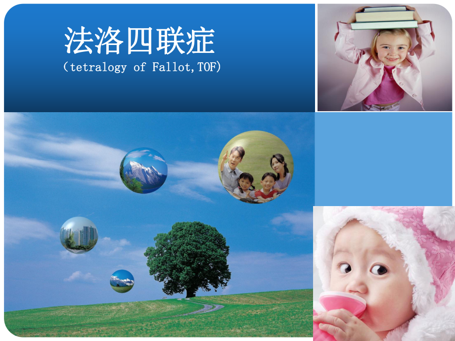 法洛四联症课件.ppt_第1页