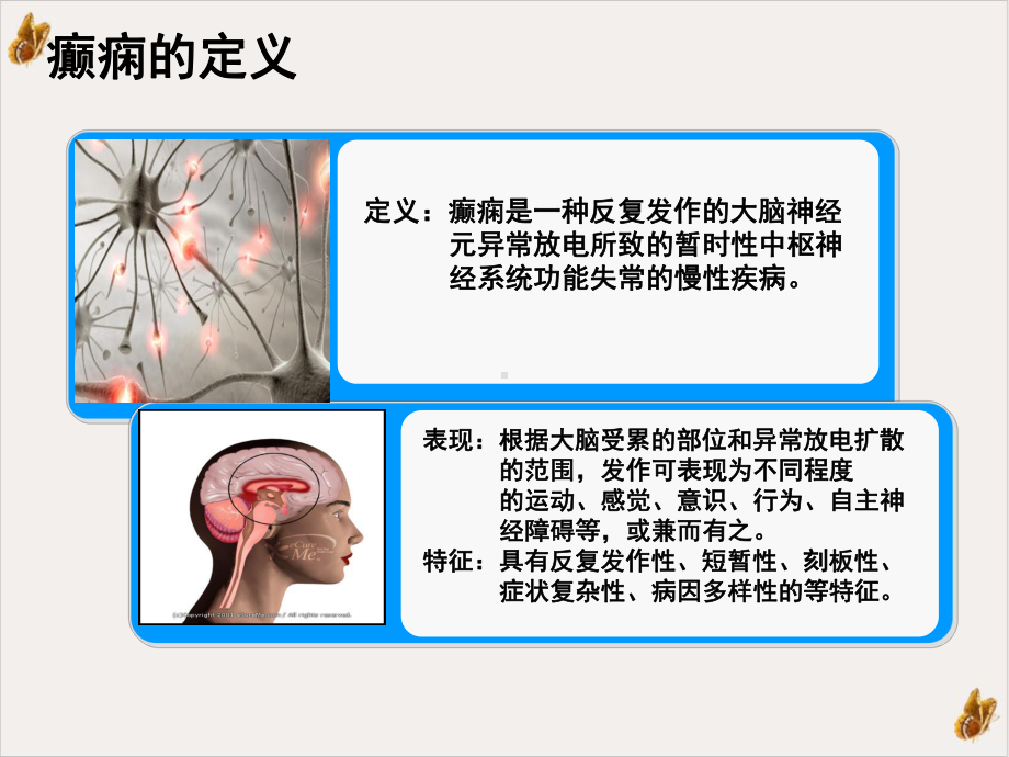 癫痫大发作急救护理ppt课件.pptx_第2页