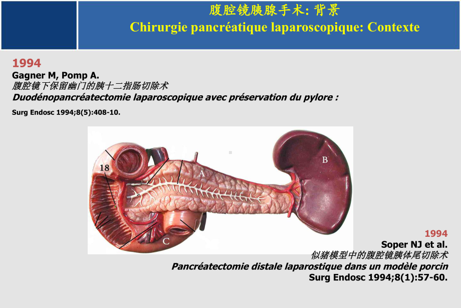 机器人胰腺外科手术课件.ppt_第3页