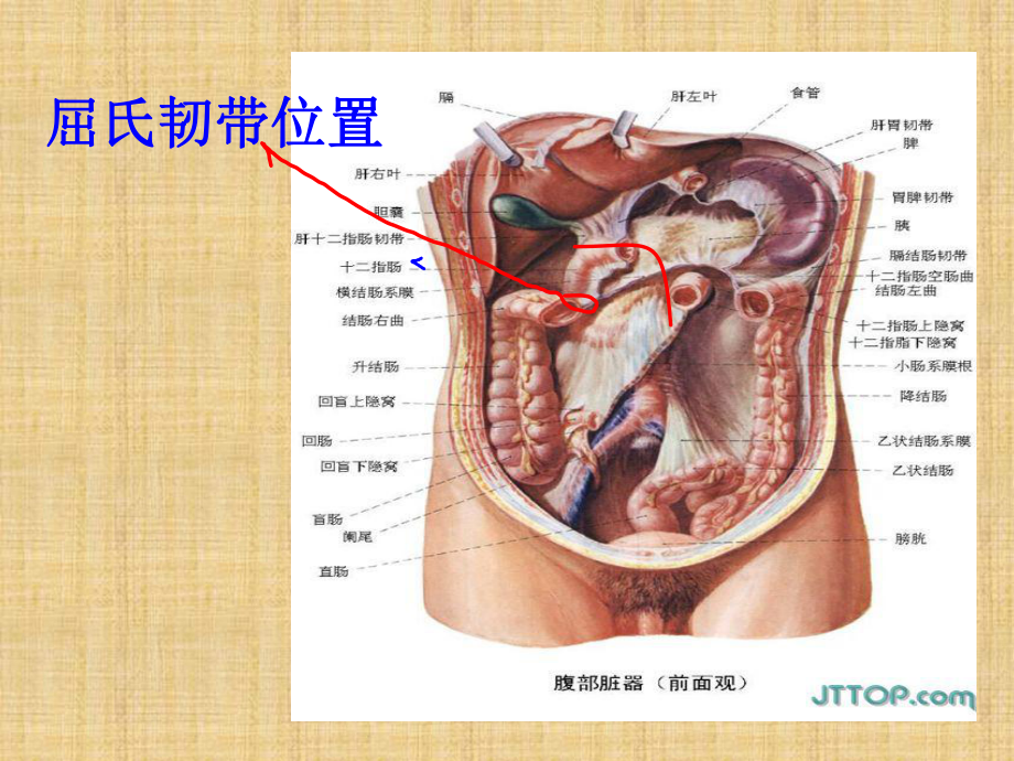 消化道出血的急救处理课件.ppt_第3页