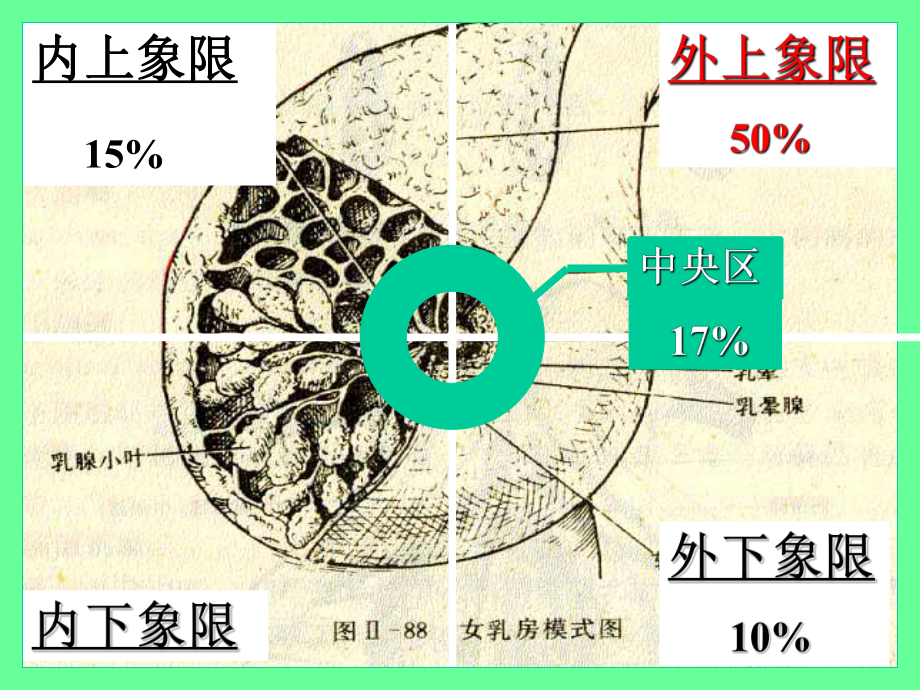 病理学课件-乳腺癌.ppt_第3页