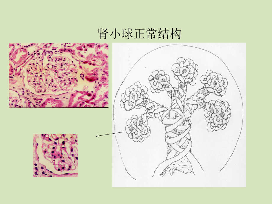 电镜与肾脏疾病课件.ppt_第3页