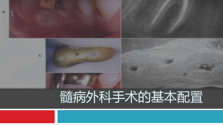 根尖手术的器械准备课件.ppt_第1页