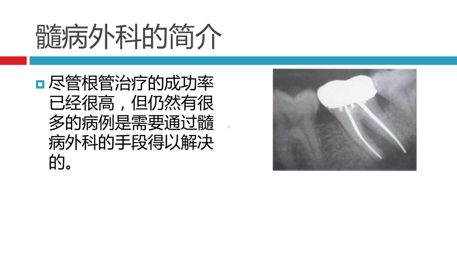 根尖手术的器械准备课件.ppt_第3页