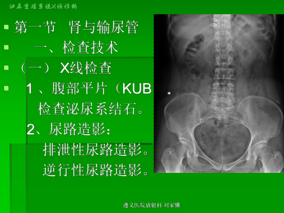 泌尿生殖系统X线诊断课件.ppt_第3页