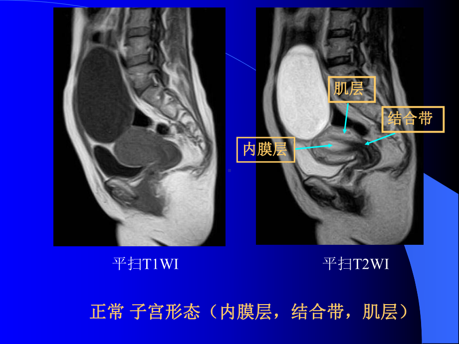 盆腔诊断学课件.ppt_第3页