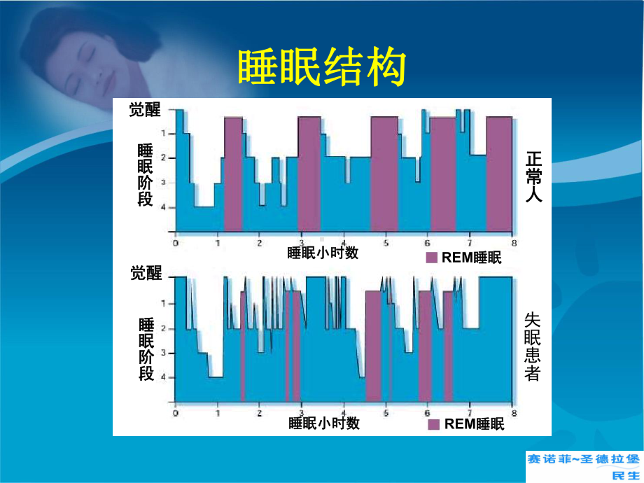 睡眠专家共识新课件.ppt_第2页