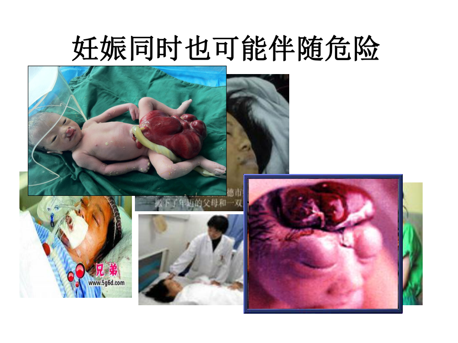 高危妊娠评分课件.ppt_第2页