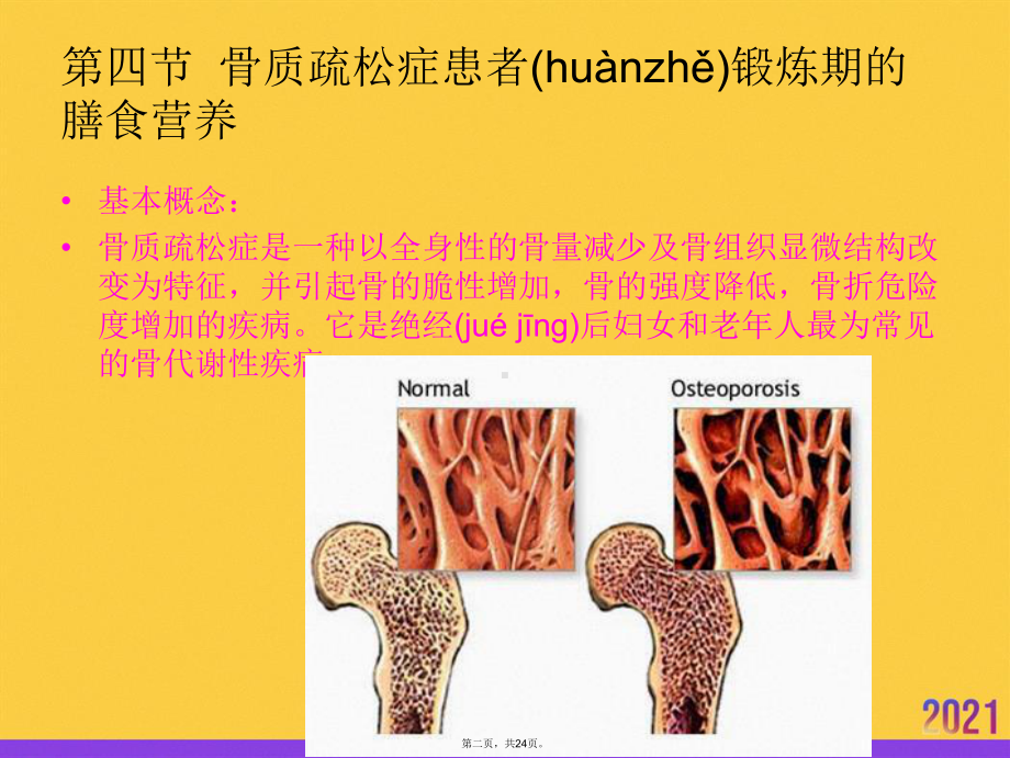 营养学骨质疏松患者锻炼期的膳食营养实用全套PPT课件.ppt_第2页