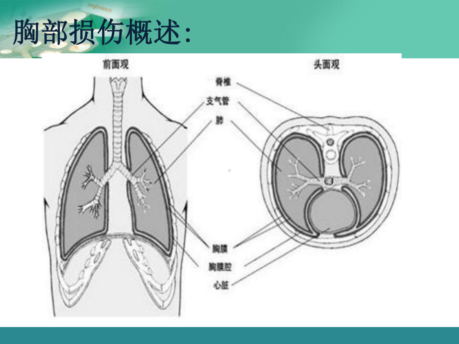 胸部疾病病人的护理课件.ppt_第2页