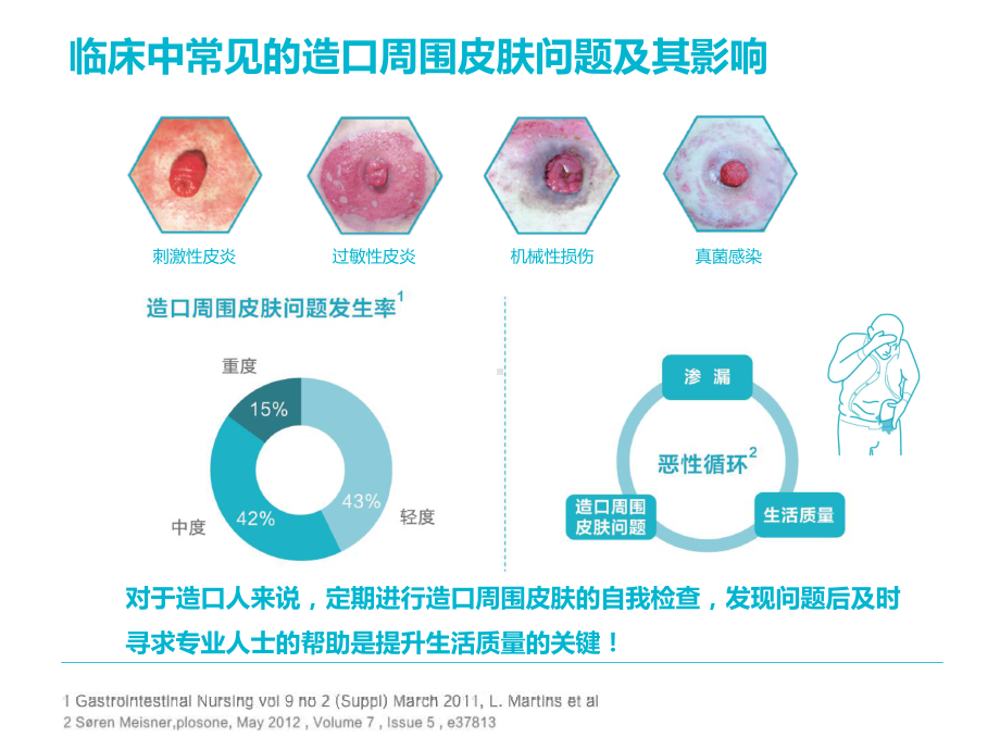 造口附件产品使用体验分享课件.pptx_第3页