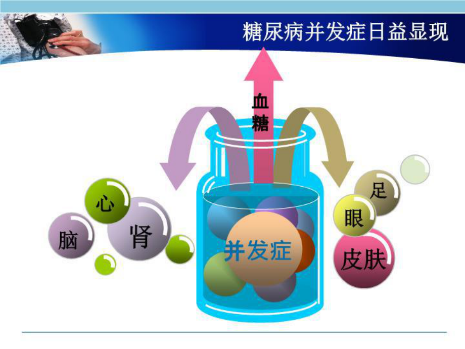 糖尿病肾病的认识与自我护理教学课件.ppt_第3页