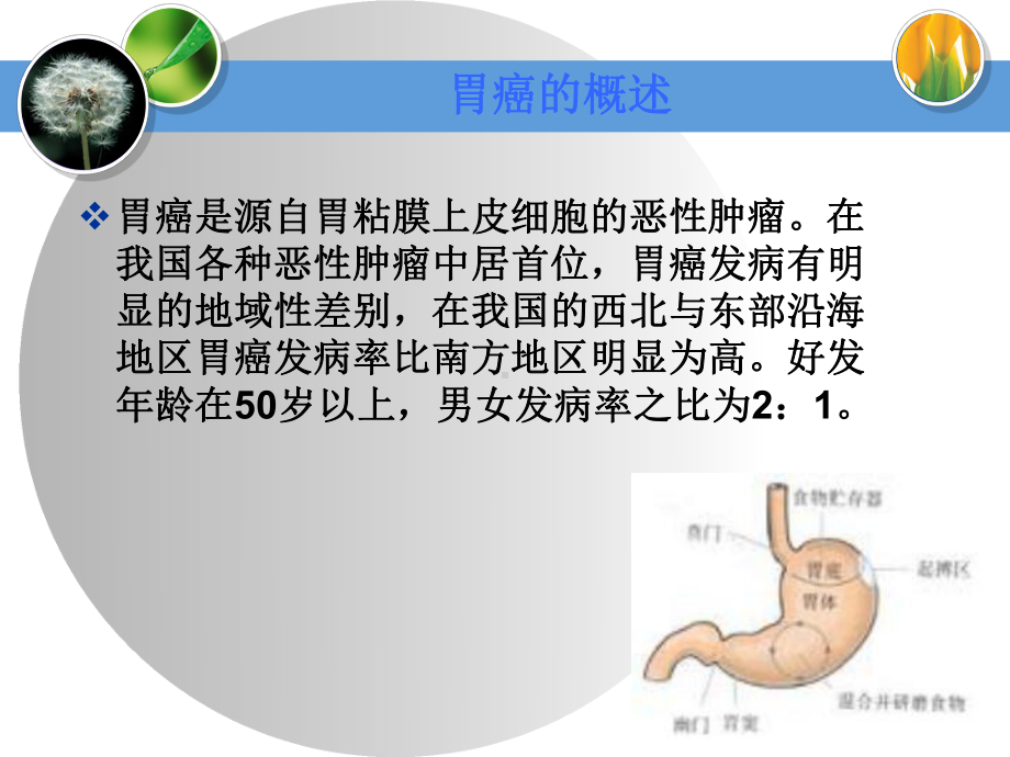 胃癌的护理教学查房课件.ppt_第2页