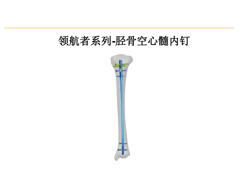 领航者系列-胫骨空心髓内钉课件.pptx_第1页