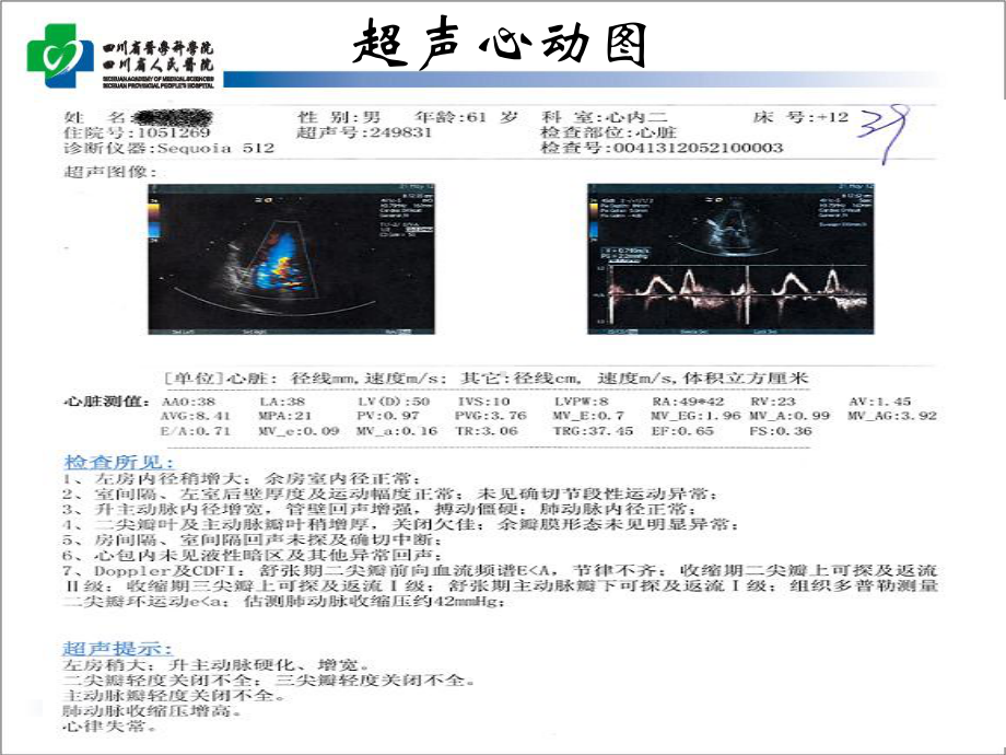 电生理病案改课件.ppt_第3页