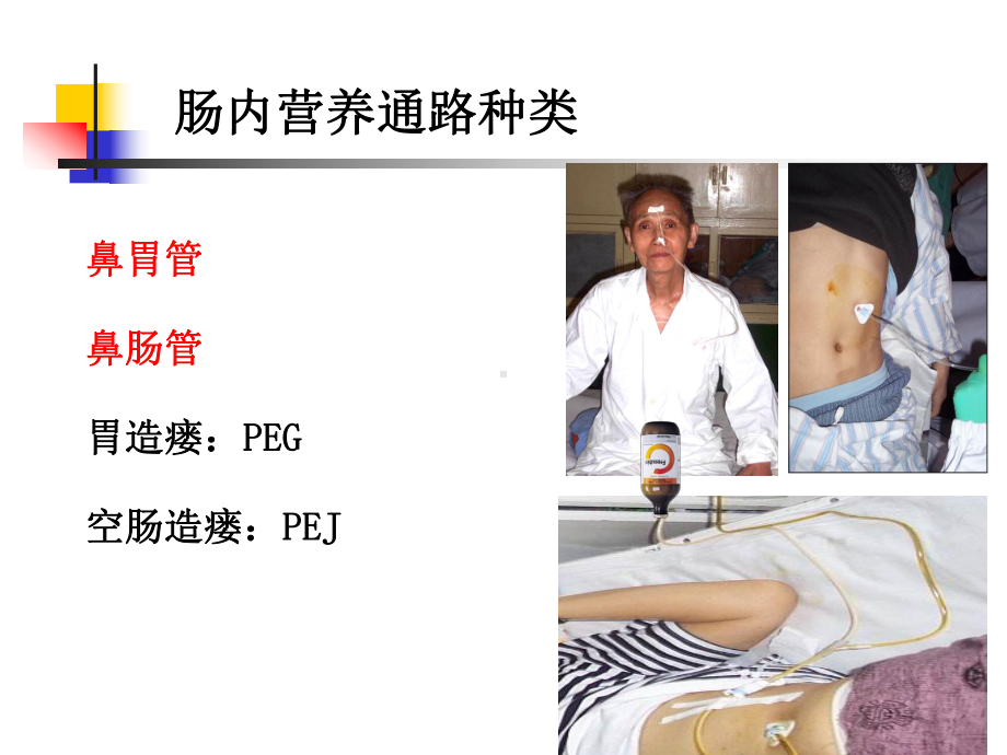 留置胃管幻灯片课件.ppt_第2页