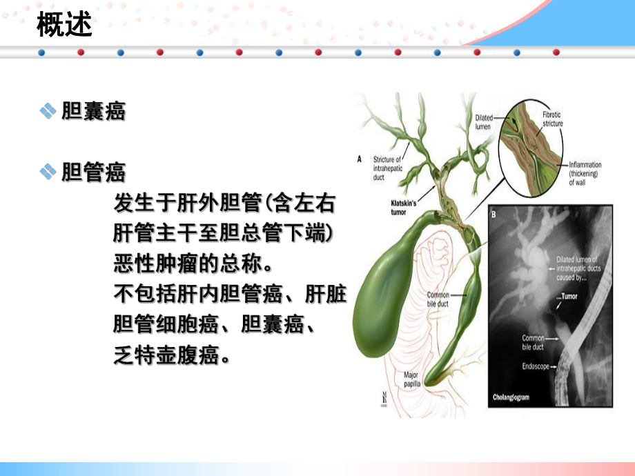 胆道系统肿瘤的化疗及靶向治疗课件.ppt_第2页