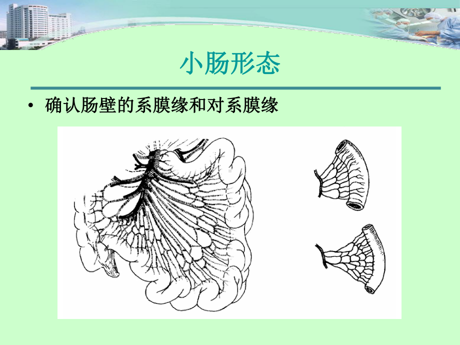 离体肠吻合(中文)课件.ppt_第3页