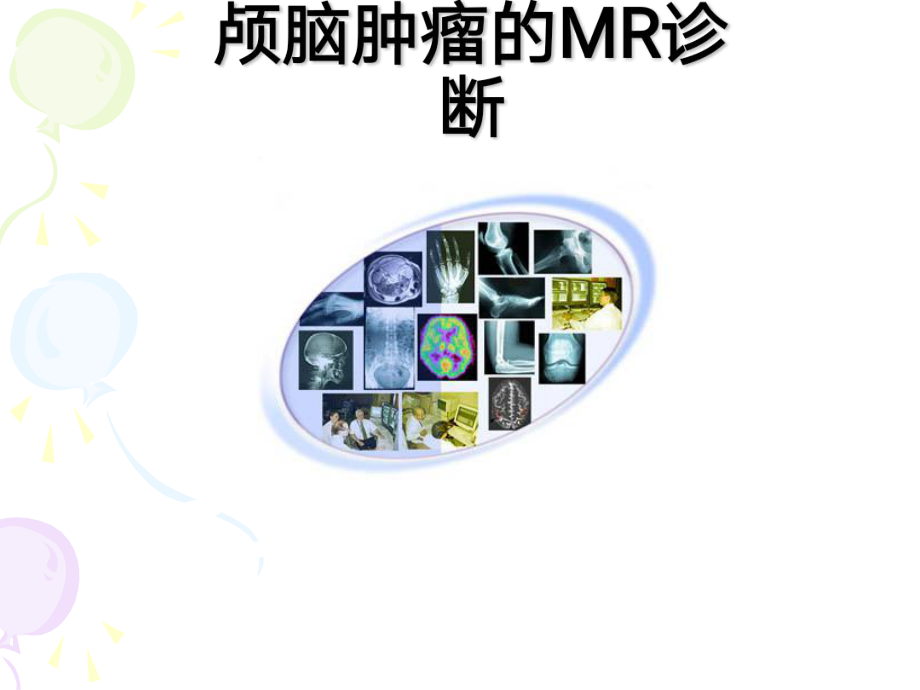 颅内肿瘤的MR诊断课件.ppt_第1页