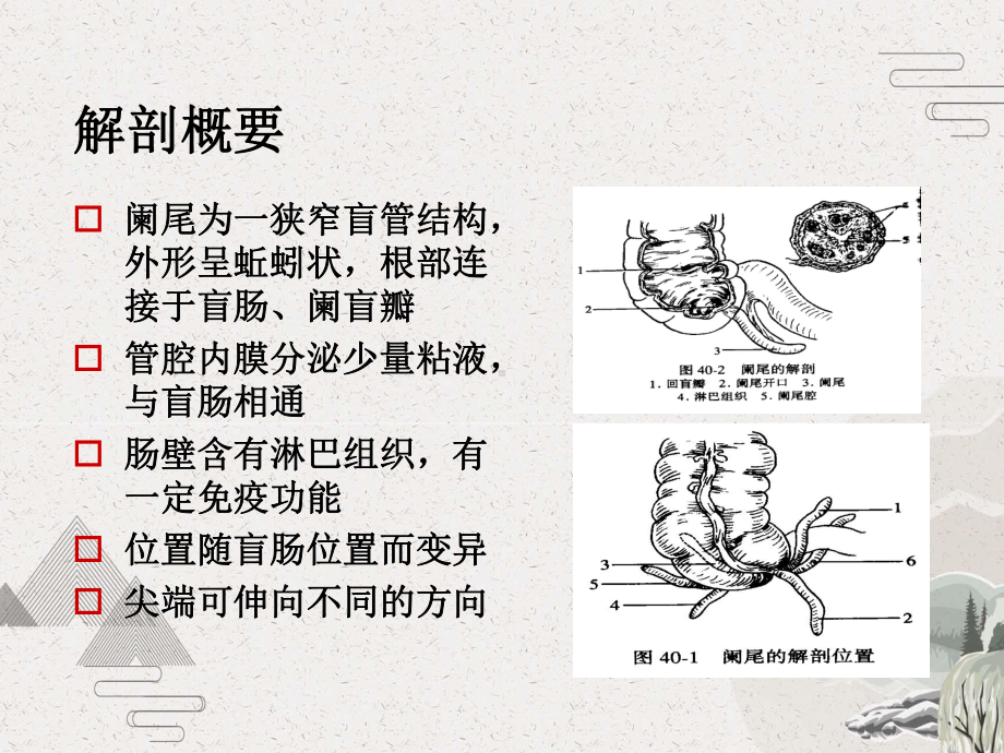 阑尾炎护理查房Ppt课件.pptx_第2页