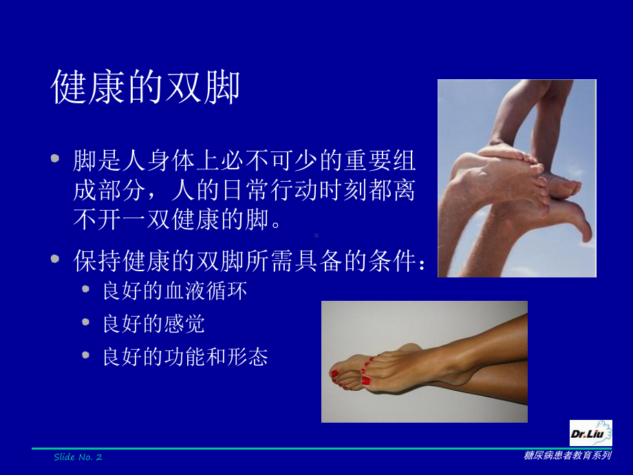 糖尿病足的防治课件.ppt_第2页