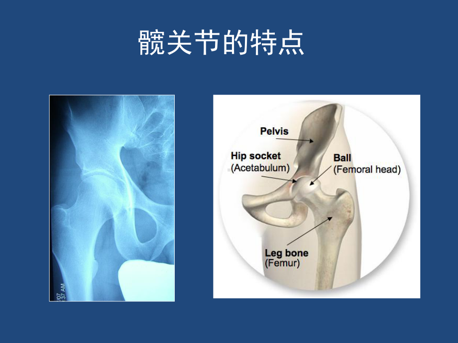 髋关节解剖与入路课件.pptx_第2页