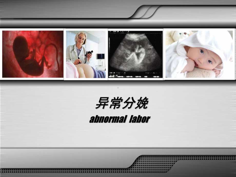 胎位异常ppt课件.ppt_第1页