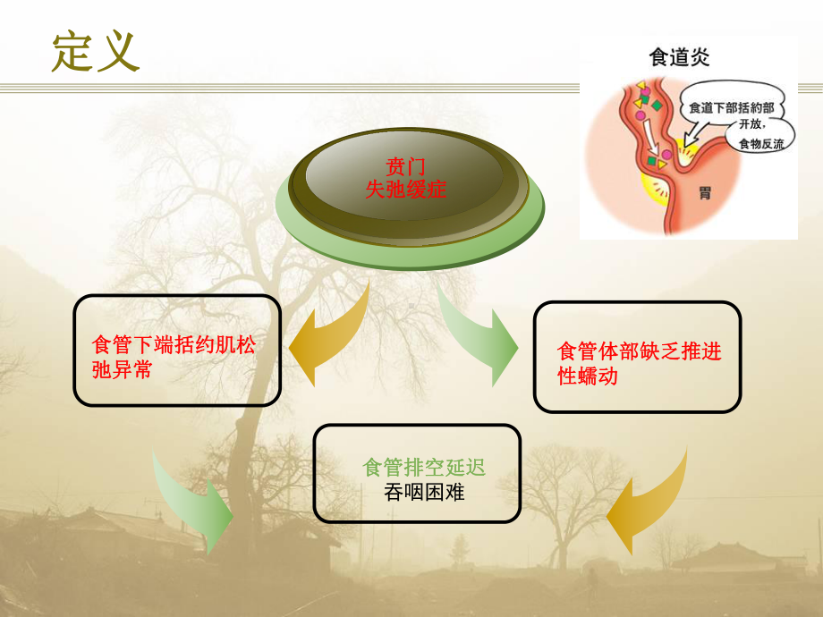 贲门失弛缓课件.ppt_第2页