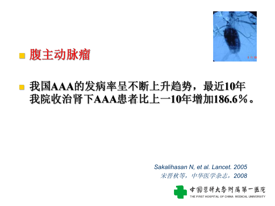 腹主动脉瘤的诊治-30年回顾课件(2).ppt_第2页