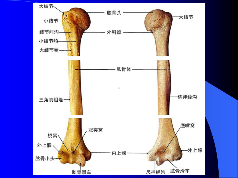 骨折病人的护理骨的完整性或连续性中断者称之为课件.ppt_第1页