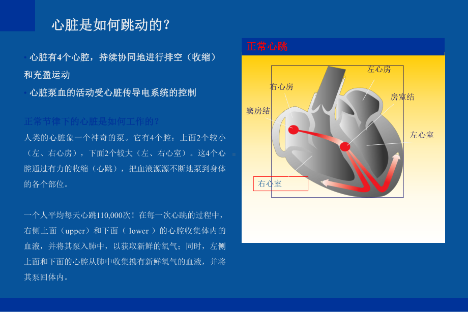 起搏器应用进展课件.ppt_第3页