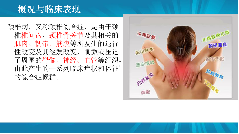 颈椎病的针灸治疗.ppt课件.ppt_第2页