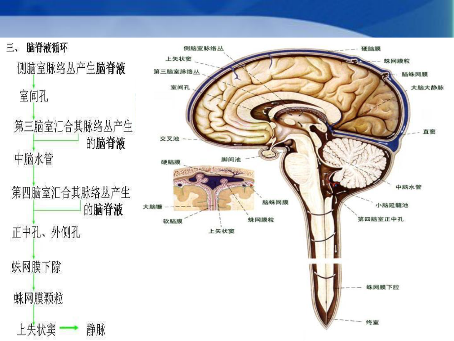 脑积水患者治疗和护理课件.ppt_第3页