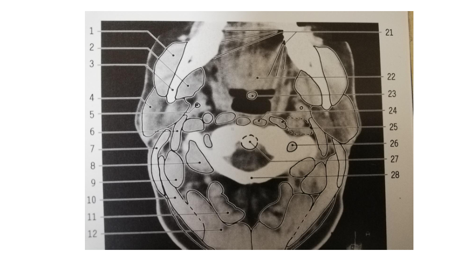 颈部正常轴位CT解剖图解课件.ppt_第2页