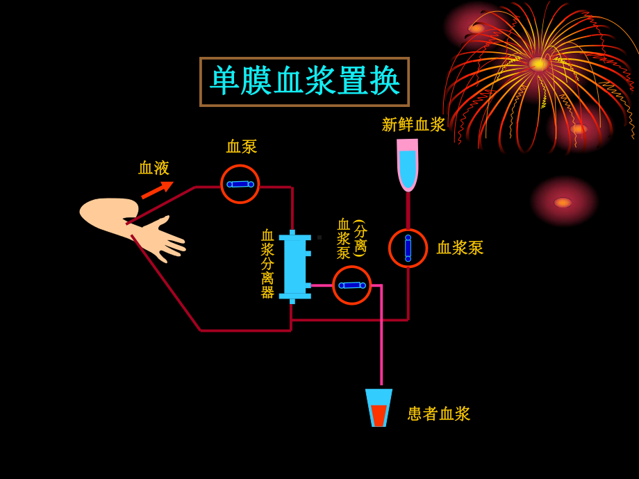 血浆置换简介课件.ppt_第3页