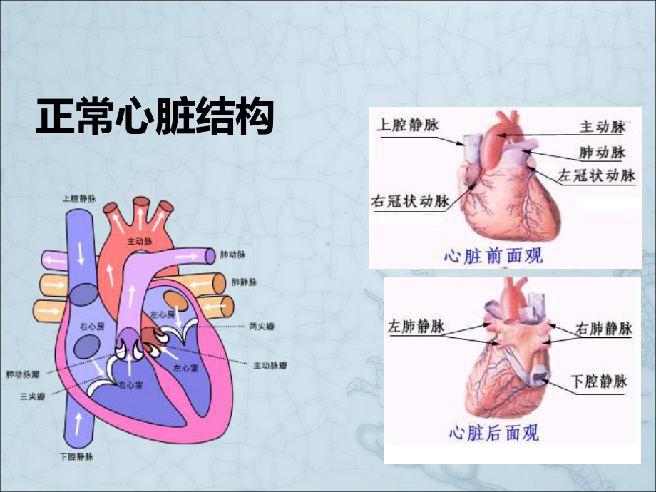 非紫绀型先天性心脏病课件.pptx_第3页