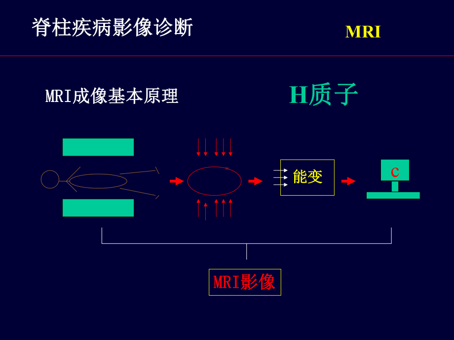 脊柱疾病MRI诊断（可编辑的PPT）课件.ppt_第2页