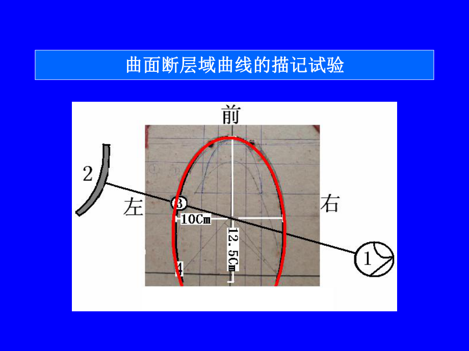 颞下颌关节的曲面断层检查体表测量定标投照技术课件.ppt_第3页