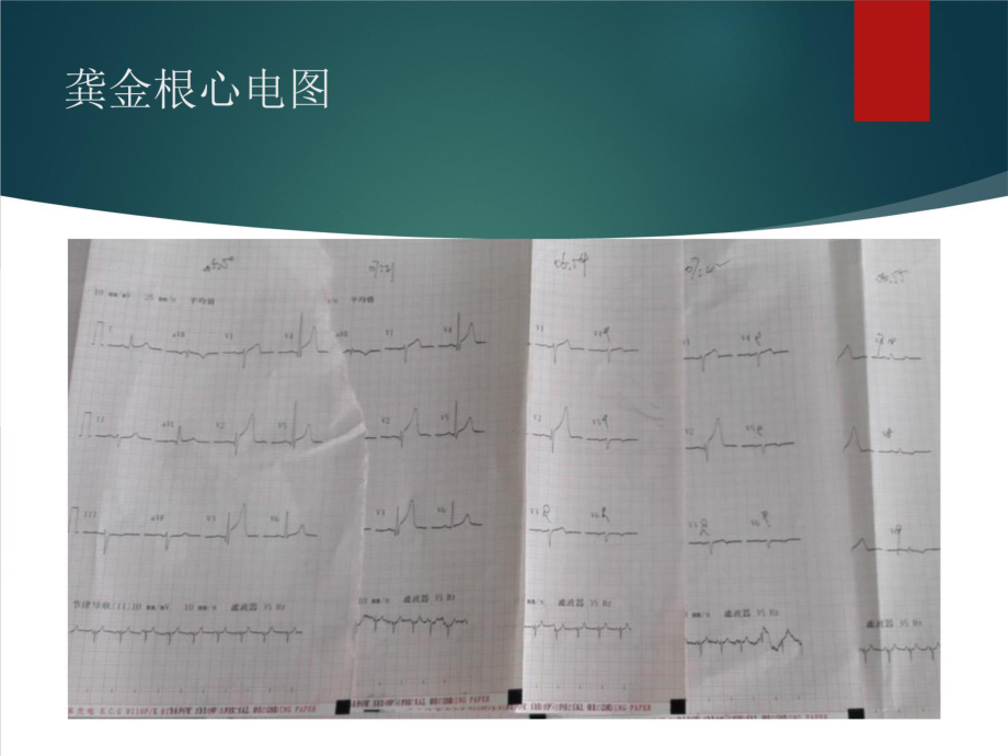 胸痛中心质量分析6讲解学习课件.pptx_第3页