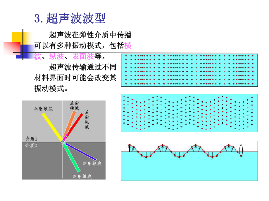 超声技术讲座课件.ppt_第3页