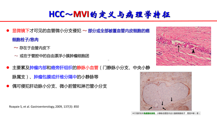 肝癌微血管侵犯的影像学评价--现状与挑战课件.pptx_第3页