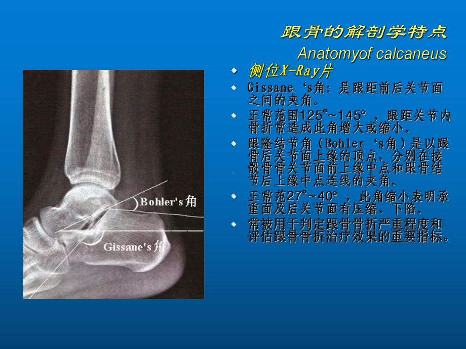 跟骨骨折的分型与治疗课件.ppt_第3页