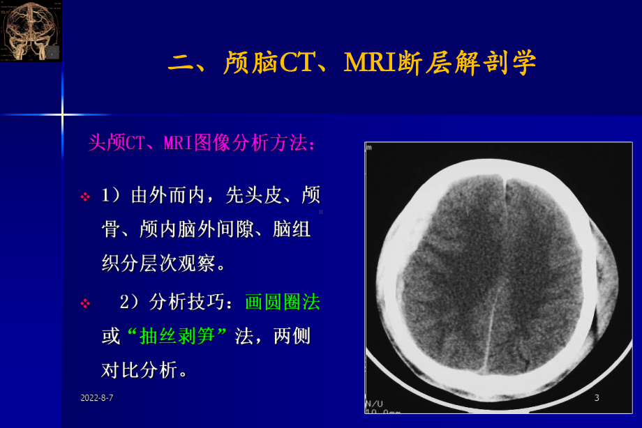 颅脑创伤的影像学诊断及其解剖学基础课件.ppt_第3页